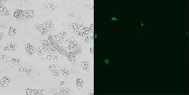 ヒトHep G2細胞：他社トランスフェクション試薬 - L2K/eGFPプラスミドDNA
