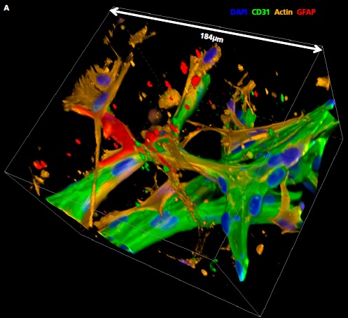 A．血管系、周皮細胞、星状細胞間の複雑な相互作用を示す微小血管網の3Dレンダリング画像