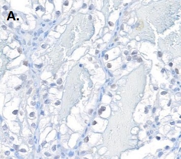 ヒトHIF2-αの免疫組織染色像