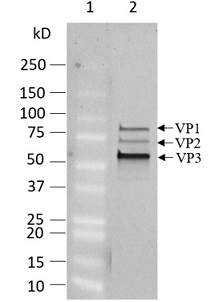 精製AAV1-ZsGreen粒子を4～20% SDS-PAGE後にゲル染色した