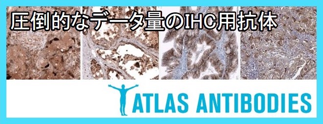 Atlas Antobodiesのバナー