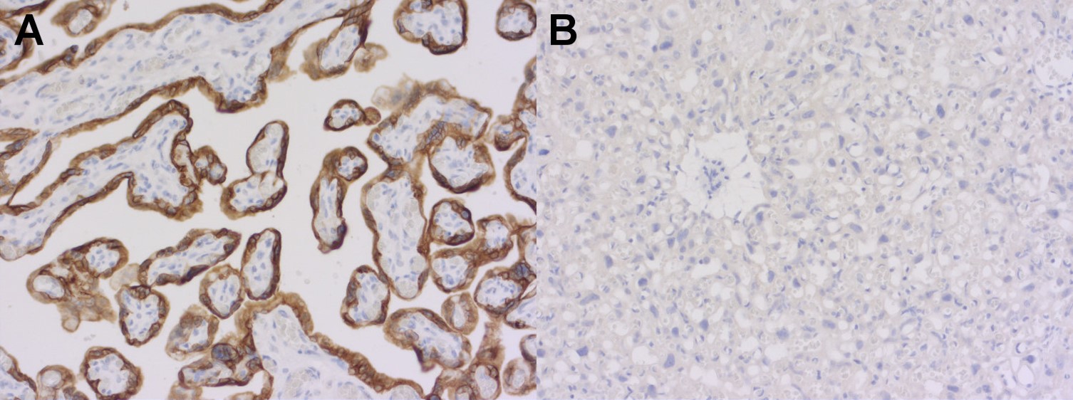 胎盤組織の免疫組織染色像（抗ヒトサイトケラチン7抗体（#HS-454017）を使用）