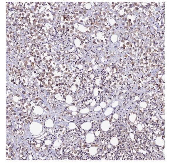 抗PON2抗体（#HPA029193）のIHC像