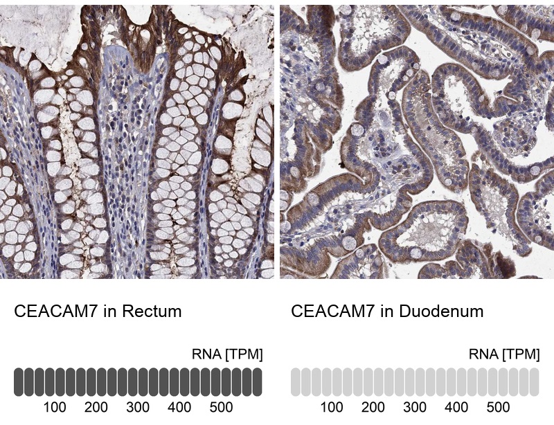 抗CEACAM7（CEA）抗体（#HPA073910）のIHC像