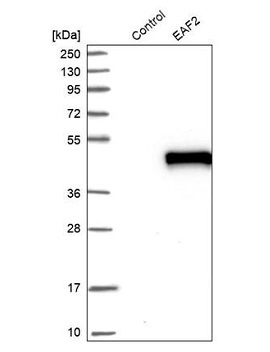 anti-TPD52(HPA062167)のIHC像