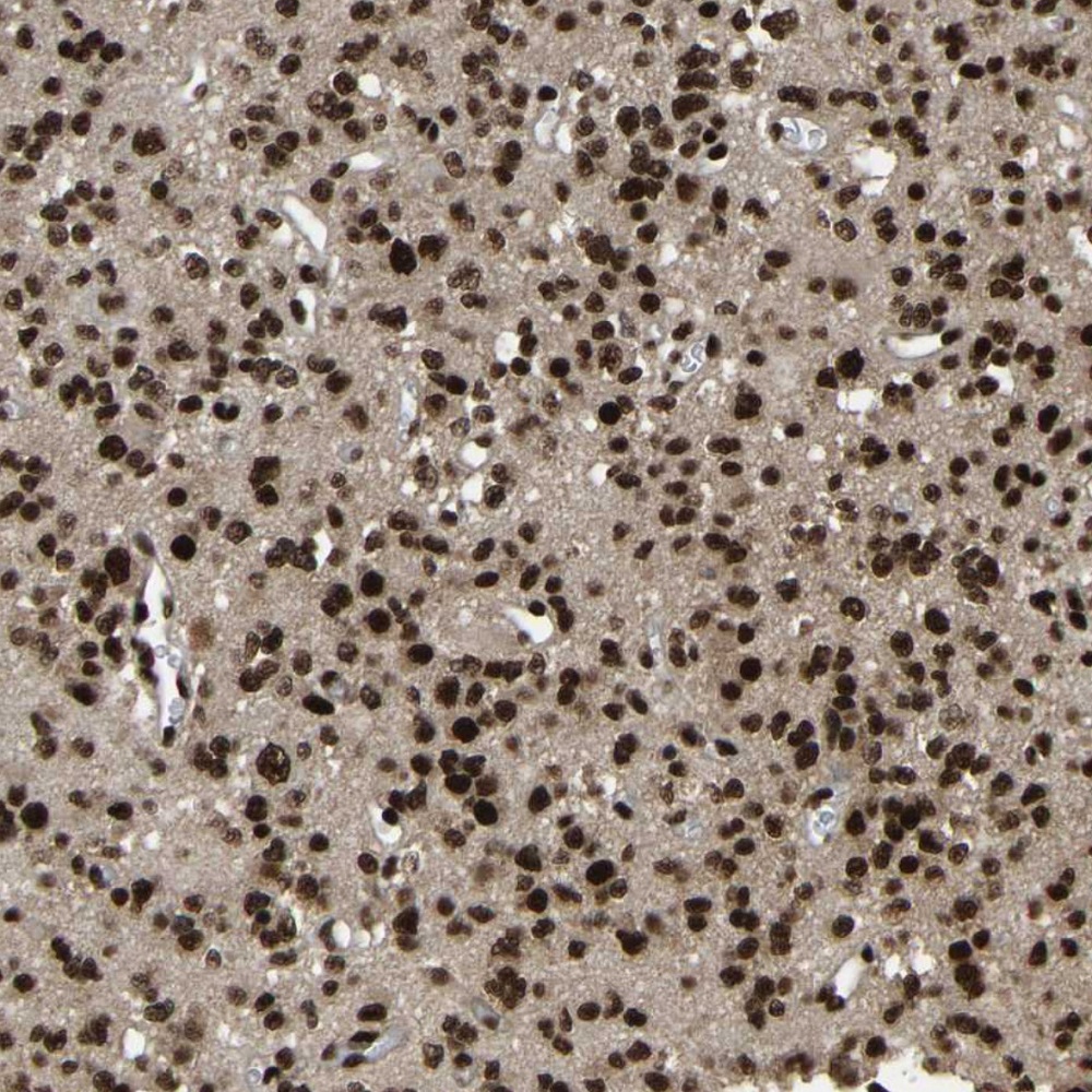 抗TBL1XR1抗体（#HPA019182）のIHC像