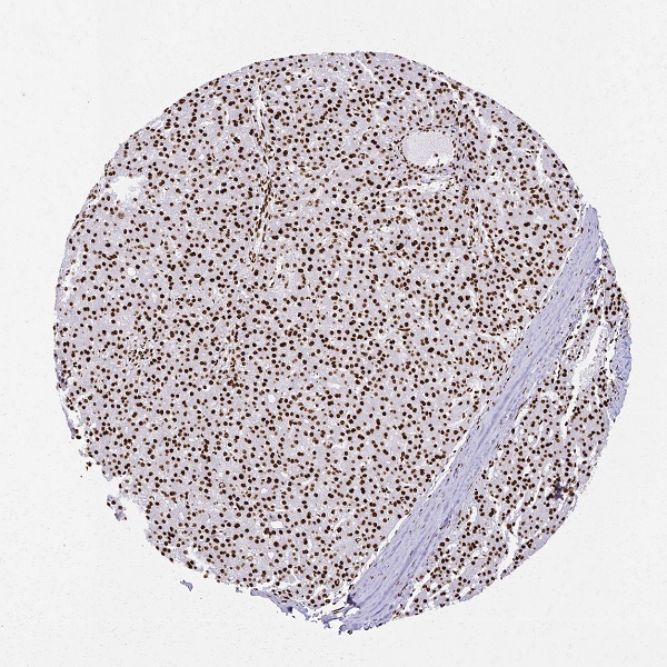 抗SFPQ抗体(#HPA054689)のIHC像