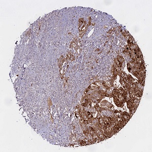 抗WFDC2（HE4）抗体（#HPA042302）のIHC像
