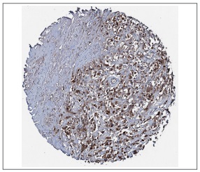 抗ACSS3抗体(#HPA047956)のIHC像