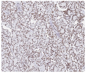 抗SNRPA1抗体(#HPA045622)のIHC像