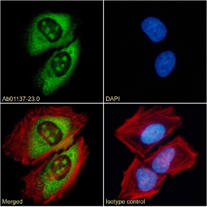 Anti-DNA/RNA Hybrid Antibody [S9.6]を用いた免疫蛍光染色像