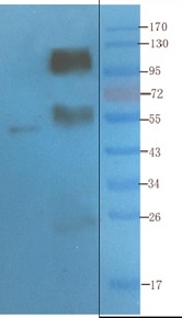 抗CD4(YNB46.1.8)抗体(#Ab00187)を用いたウエスタンブロット像