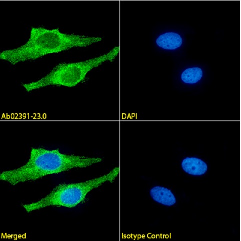 HeLa細胞の免疫蛍光染色像