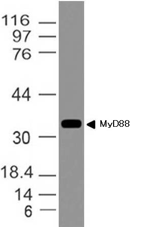 抗MyD88抗体