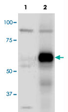 抗リン酸化抗体を用いたATG13 (phospho S318)の検出例