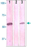 抗リン酸化抗体を用いたIRAK4 (phospho T345)の検出例