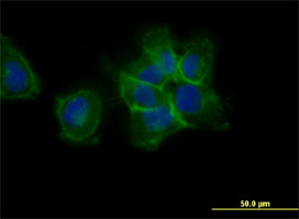 希少循環細胞に対する抗体 Circulating Rare Cell (CRC) Antibodyの使用例1