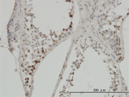 希少循環細胞に対する抗体 Circulating Rare Cell (CRC) Antibodyの使用例3