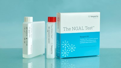 The NGAL Test Reagent Kitの製品外観