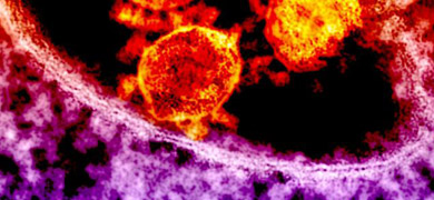 ウイルス産生用細胞ウェビナー