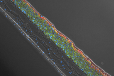 表皮細胞の三次元モデルウェビナー