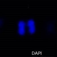 有糸分裂中のHepG2細胞のDAPI免疫蛍光染色像