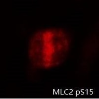 有糸分裂中のHepG2細胞のMLS2-pS15免疫蛍光染色像