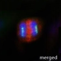 有糸分裂中のHepG2細胞の重ね合わせ免疫蛍光染色像