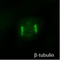 有糸分裂中のHepG2細胞のb-tubulin免疫蛍光染色像