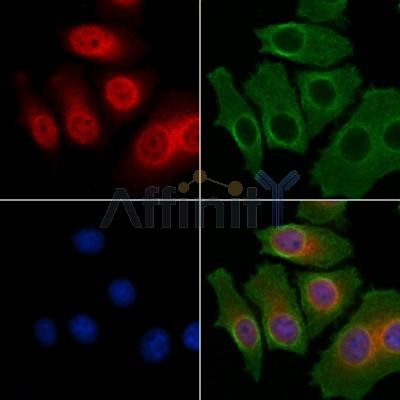 抗NF-κB p65抗体（#AF5006）を用いた免疫蛍光染色像