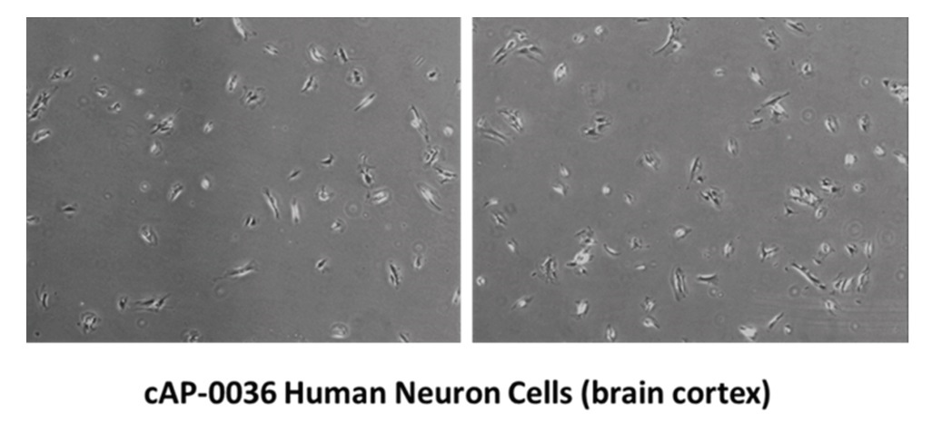 Human Neuron Cellsヒト脳細胞の画像