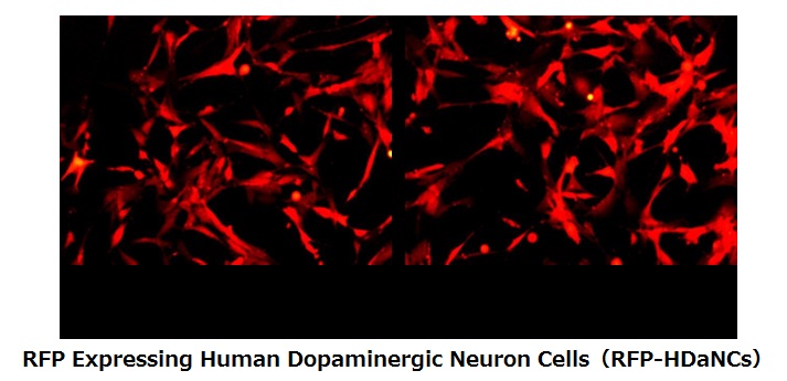 RFP Expressing Human Dopaminergic Neuron Cellsドーパミン作動性ニューロンの画像