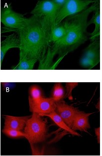 ウサギ抗チューブリン抗体（IgG） とHiLyte Fluor 488／647標識プロテインAを用いた3T3細胞の免疫染色像