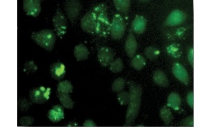 HeLa細胞によるCPPの取込み Green HeLa