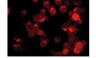 HeLa細胞によるCPPの取込み Red HeLa