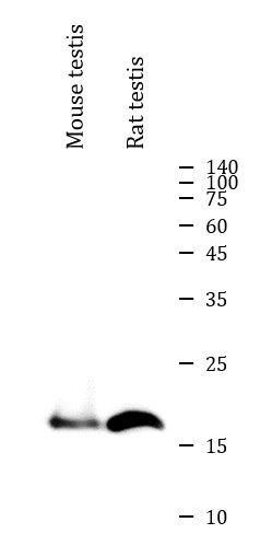 Anti-GPX4 antibody（#ARG41400）を用いたウエスタンブロット像
