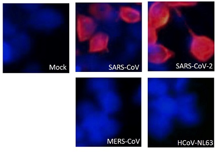 anti-SARS-CoV / SARS-CoV-2 (#ARG66735)の蛍光免疫染色例