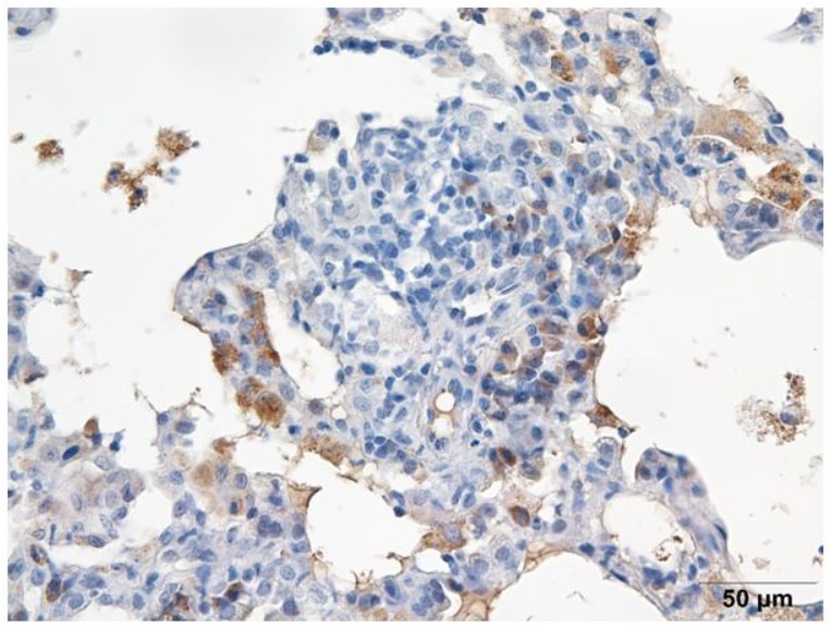 ARG66476を用いたラット肺組織の免疫組織染色像