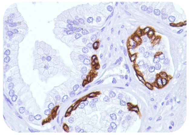 Anti-CK14 Antibody [SP53] (#ARG53180）の免疫組織染色像