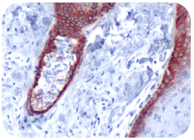 Anti-CK5 Antibody（#ARG53200）の免疫組織染色像