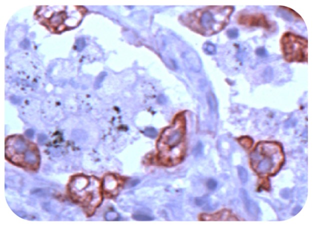 Anti-CK8 Antibody（#ARG53215）の免疫組織染色像