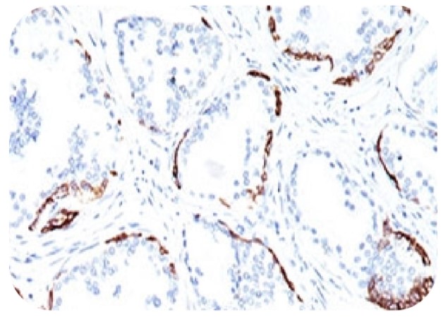 Anti-HMW Cytokeratin Antibody [34BE12]（#ARG55990）の免疫組織染色像