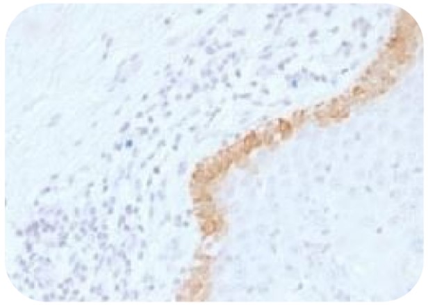 Anti-CK15 Antibody [LHK15]（#ARG62526）の免疫組織染色像