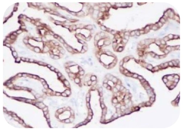 Anti-CK19 Antibody [SQab1872]（#ARG66324）の免疫組織染色像