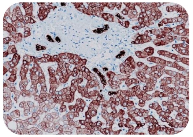 Anti-Basic Cytokeratin Antibody [SQab1885]（#ARG66337）の免疫組織染色像