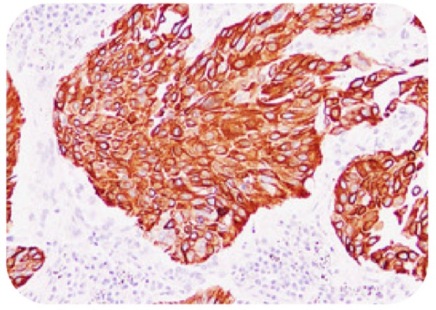 Anti-CK13 Antibody (#ARG66490）の免疫組織染色像