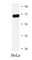 Anti-Hsp 70 antibody（#ARG41052）を用いたウエスタンブロット像