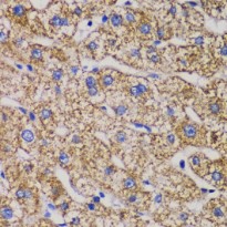 Anti-DLST antibody（#ARG43830）を用いた免疫組織染色（IHC）像