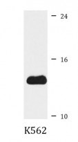 Anti-FDX1 / Ferredoxin antibody（#ARG58670）を用いたウエスタンブロット像