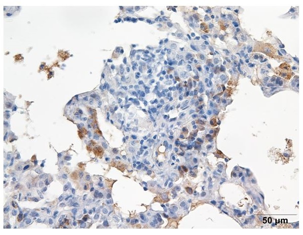 珪肺症モデルラットの肺組織の免疫組織染色像